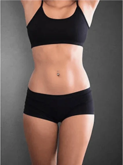 Bauch – frontal – nachher